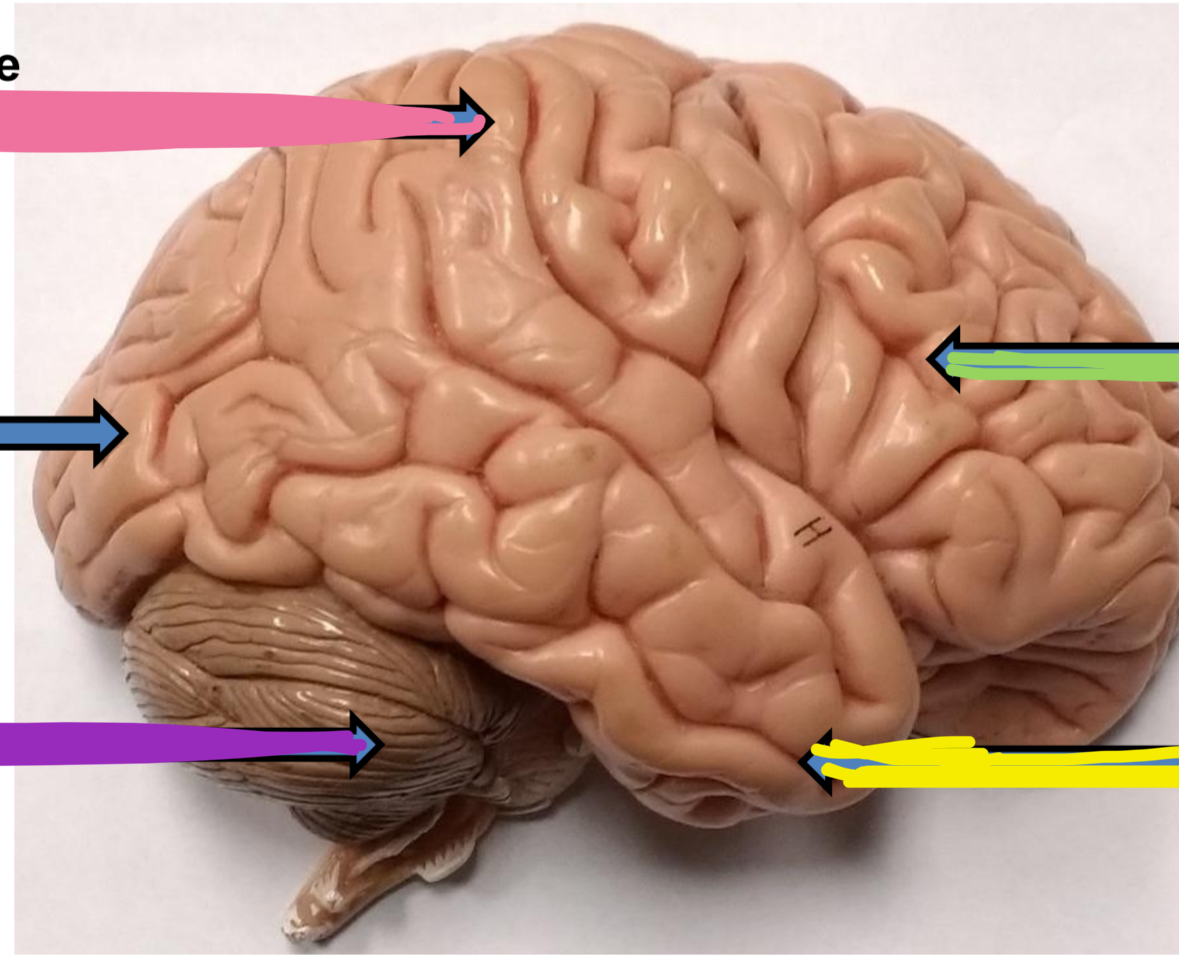 <p>Pink points to what lobe of the brain</p>