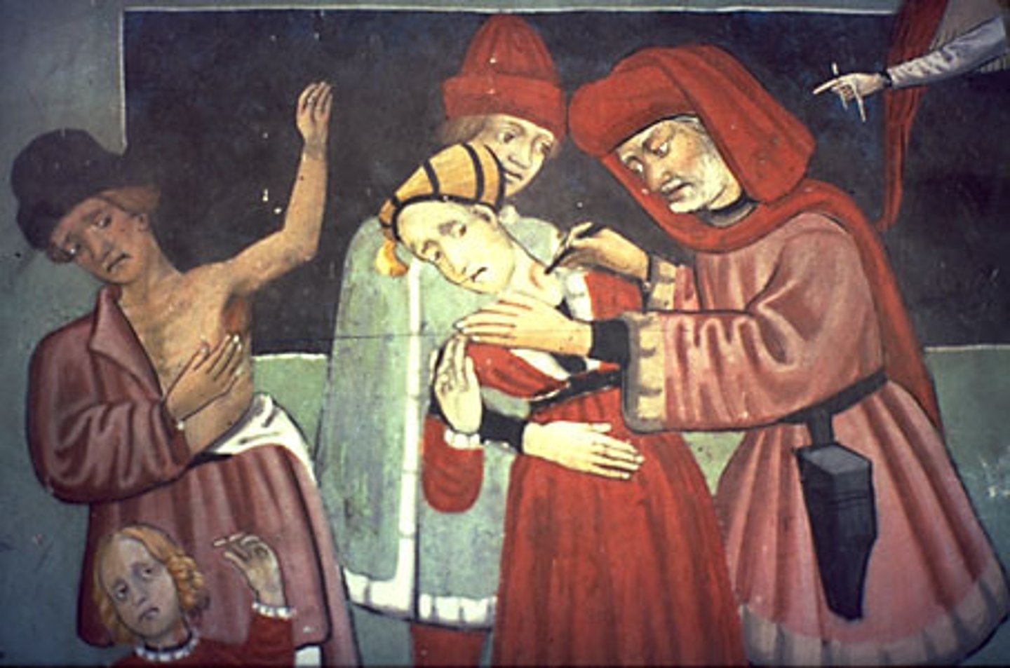 <p>Sometimes barber surgeons would lance (cut open) the buboes, squeezing out all of the pus. Occasionally this helped the victim survive.</p>