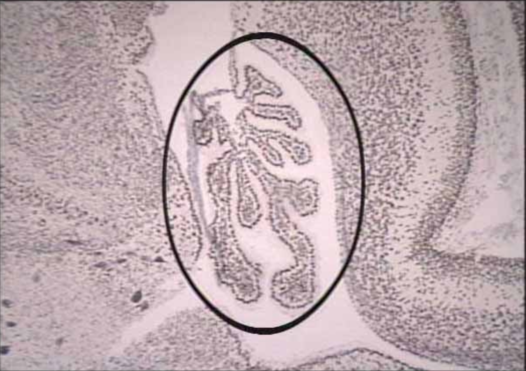 <p>What is circled?</p>