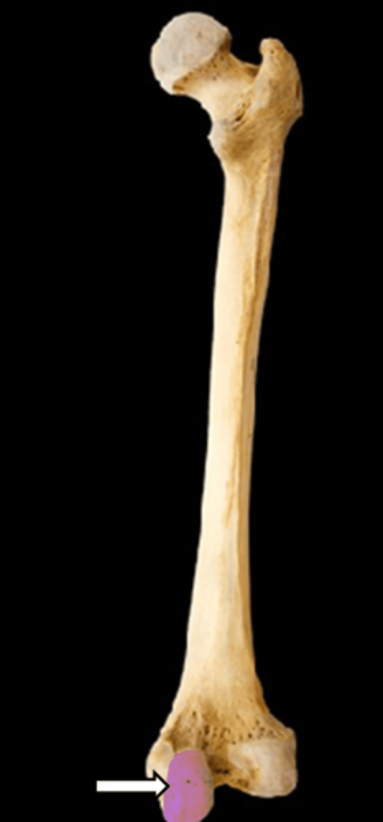 <p>name the part</p>
