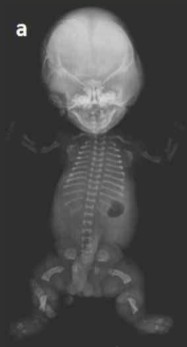 <ol><li><p>What is abnormal about this image?</p></li><li><p>This finding can be associated with what pathology?</p></li></ol><p></p>