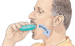 The damage from emphysema is permanent. The ability to breathe properly cannot be fully recovered. Treatment of emphysema aims to ease symptoms and stabilize the condition. 

Treatments include:
-supplemental oxygen
-inhaled bronchodilators
-inhaled steroids
-smoking cessation
-lung surgery to remove damaged tissue
-lung transplant