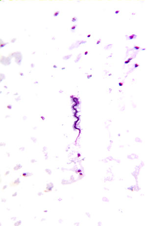 Brugia malayi microfilariae