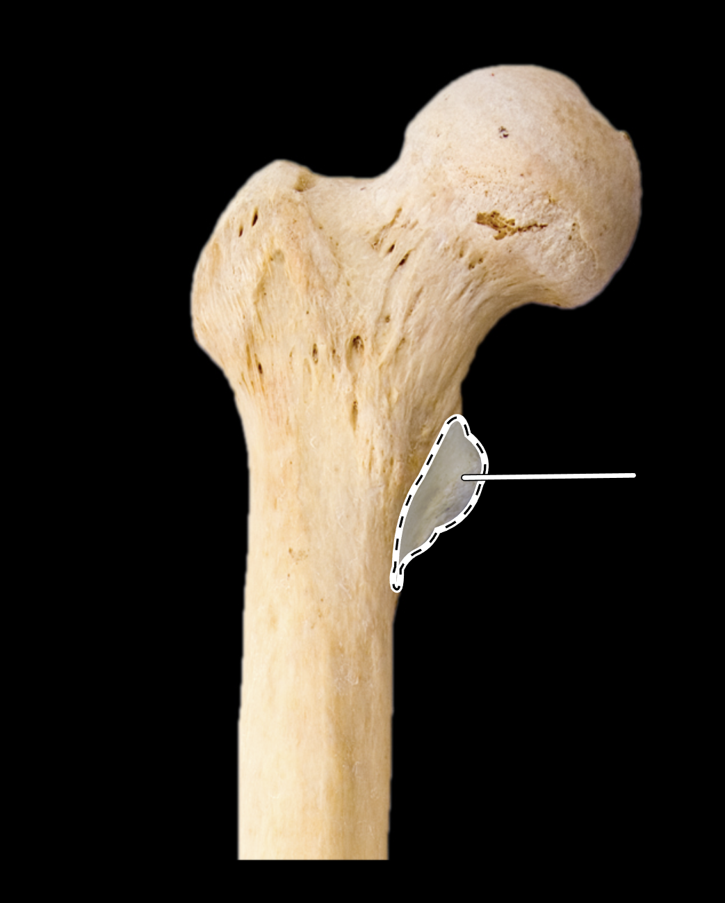 <p>Name the highlighted portion.</p><p>(Anterior view, right side).</p>