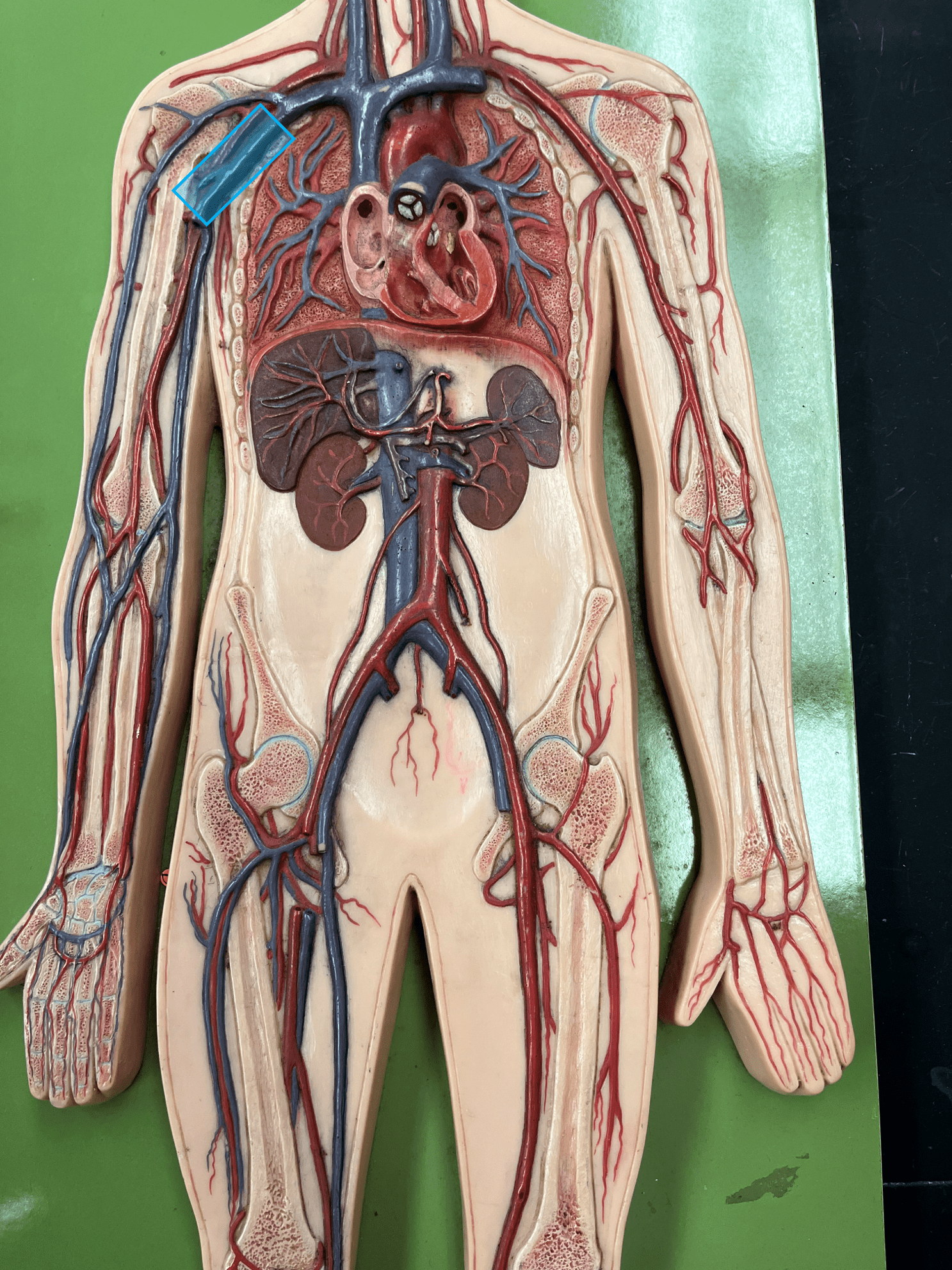 <p>• A vein of the upper limb.</p>
<p>• Drains the brachial and cephalic veins.</p>
<p>• Empties into the subclavian vein.</p>