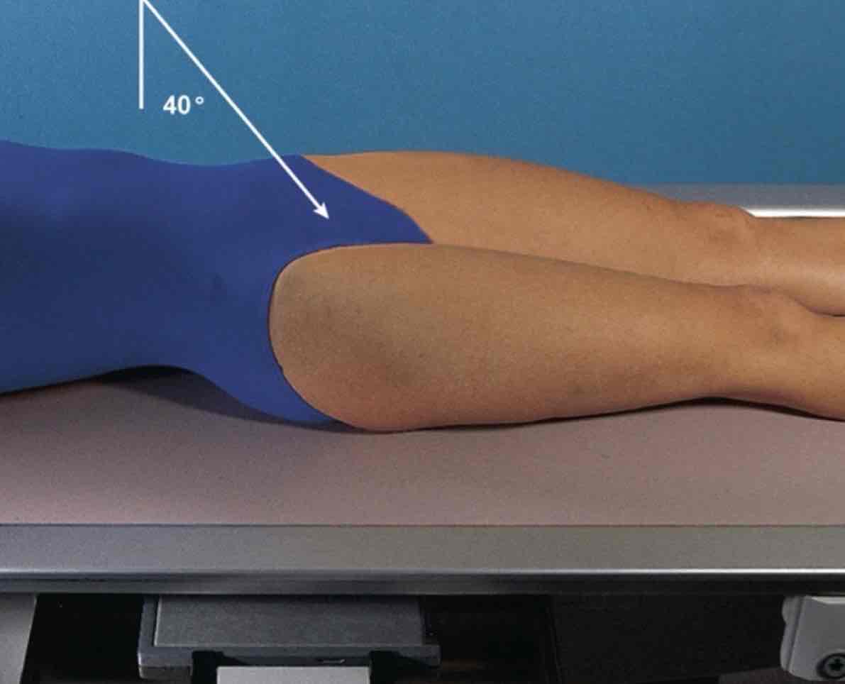 <p>What Projection is this?</p>