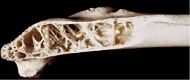 <p>Hollow bone containing air spaces connected to the respiratory tract; e.g., humerus, femur.</p>