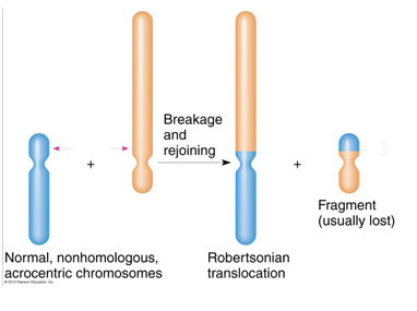 <p>-individuals with a balanced Robertsonian translocation (carriers) have no loss or gain of significant genetic material and usually do not exhibit any clinical symptoms; have 45 chromosomes instead of the usual 46</p><p>-carriers typically have no “syndromic” phenotype, there are issues with infertility; carriers may experience increased risk of miscarriage due to production of unbalanced gametes</p>