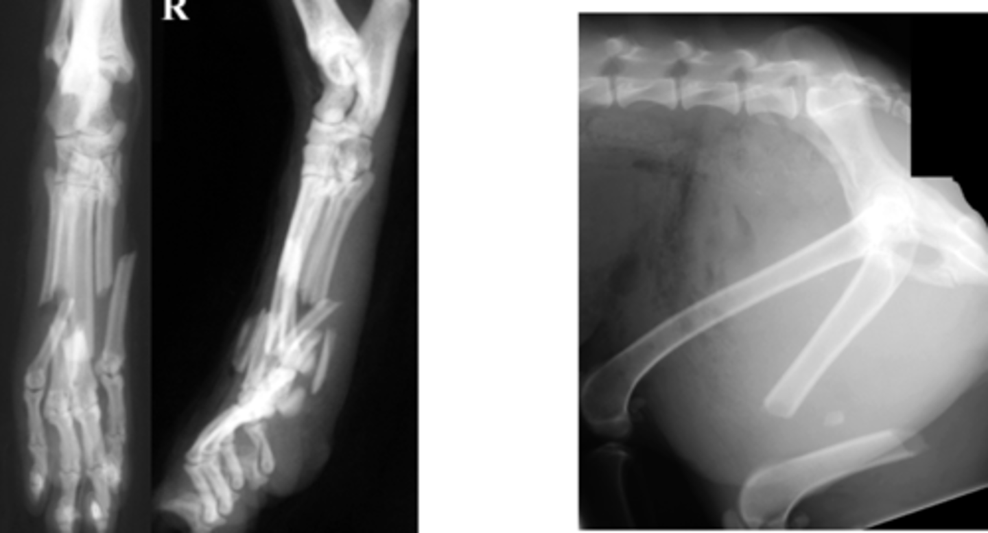 <p>Identify the fracture type?</p>