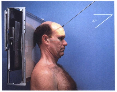 <p><span style="color: oklch(0.3039 0.04 213.68);">In the AP axial projection of the sellar region, a 37-degree caudal angulation projects the ______________ and ______________ within the foramen magnum.</span></p>