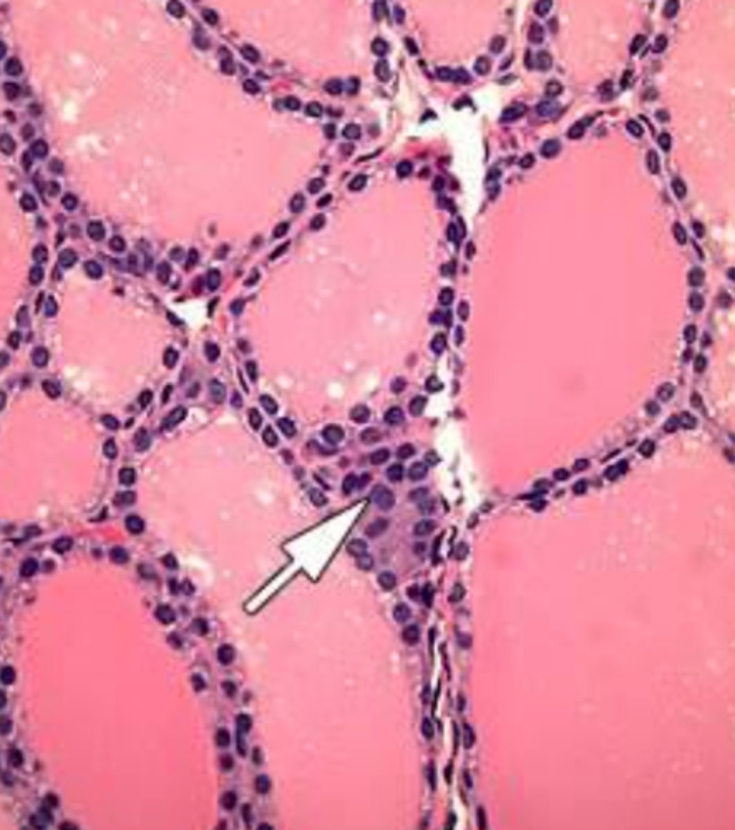 <p>What cells in the Thyroid...</p><p>&gt; Sit at the corner of 4 follicles</p><p>&gt; Synthesize Calcitonin</p>