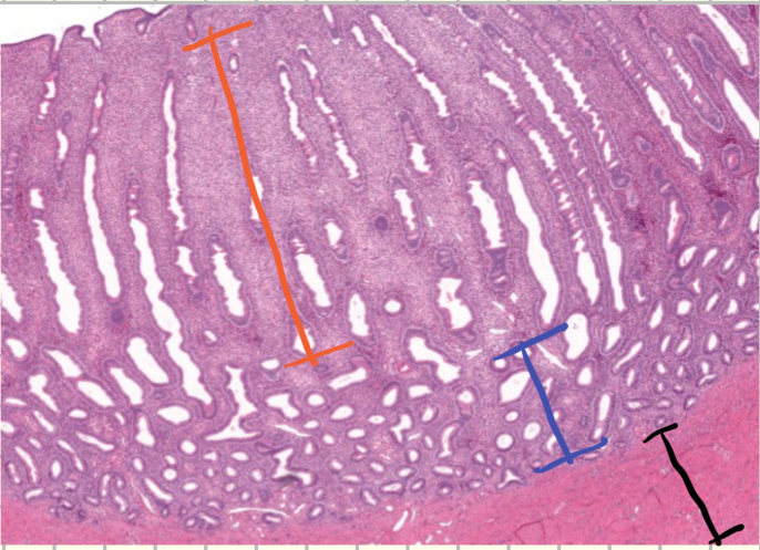 <p>What’s in blue?</p>