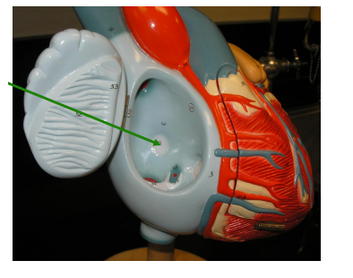 <p><span><span>Name the structure at the end of the arrow.&nbsp; The small indentation.</span></span></p>