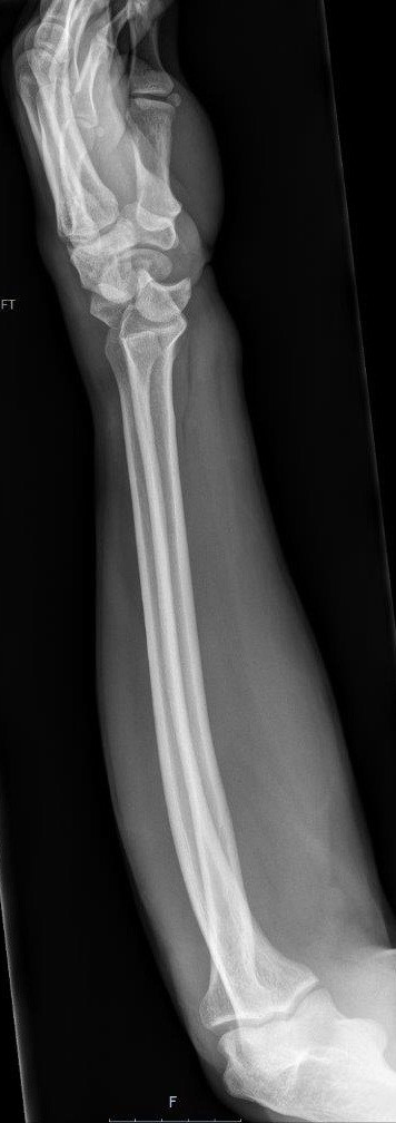 <p>Describe the abnormality demonstrated.</p>