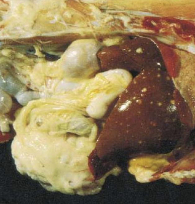 <p>usually present with disseminated disease (spleen, bone marrow, liver most commonly)</p>