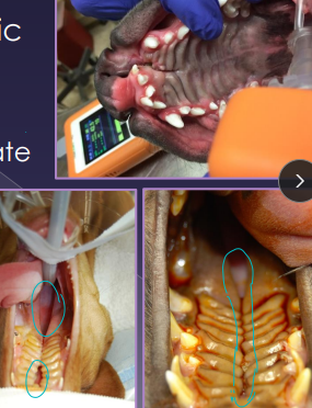 <ul><li><p><strong>Primary (premaxilla/lip) → aesthetic only</strong></p><ul><li><p><span style="color: rgb(136, 136, 136);"><strong>Et:</strong> </span>congenital, intrauterine insult 25-28d&nbsp;</p><ul><li><p>unilateral, aesthetic, <strong>direct access between oral cavity and nasal cavity</strong></p></li></ul></li><li><p><span style="color: rgb(136, 136, 136);"><strong>Sig:</strong></span><strong> </strong>young, brachycephalics</p></li><li><p><span style="color: rgb(136, 136, 136);"><strong>Cs:</strong></span> food caught in rostral nasal cavity</p></li><li><p><span style="color: rgb(136, 136, 136);"><strong>Tx:</strong> </span><strong>Sx repair at 5-6m : cosmetic only&nbsp;</strong></p></li></ul></li><li><p><strong>Secondary (hard/soft palate)</strong></p><ul><li><p><span style="color: rgb(136, 136, 136);"><strong>Et:</strong></span> <strong>congenital (#1)</strong>, intrauterine <strong>insult 25-28d</strong>, traumatic, <strong>midline</strong></p></li><li><p><span style="color: rgb(136, 136, 136);"><strong>Sig: </strong></span>young, brachycephalics</p></li><li><p><span style="color: rgb(136, 136, 136);"><strong>Cs: </strong></span>milk from nose, coughing, gagging, sneezing, nasal discharge, poor growth</p></li><li><p><span style="color: rgb(136, 136, 136);"><strong>Tx: </strong></span><strong>palatoplasty at 12-14w (short fasting time 4-6h)</strong></p><ul><li><p>Too early → friable tissue, poor anesthesia candidate</p></li><li><p>Too late → defect widens</p></li></ul></li></ul></li></ul><p></p>