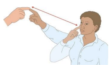 <p>*be far enough to where patient must fully extend their arm</p><ul><li><p>with eyes open, have patient alternative touching your index finger and their nose</p></li><li><p>move your finger continuously and have patient continue alternating touching your index finger and their nose  </p></li><li><p>with your finger unmoving directly in front of patient, have them touch your finger then have them close their eyes and repeat</p></li></ul><p>watching for: end point tremor, dysmetria: problems with coordination/point passing</p><p></p>