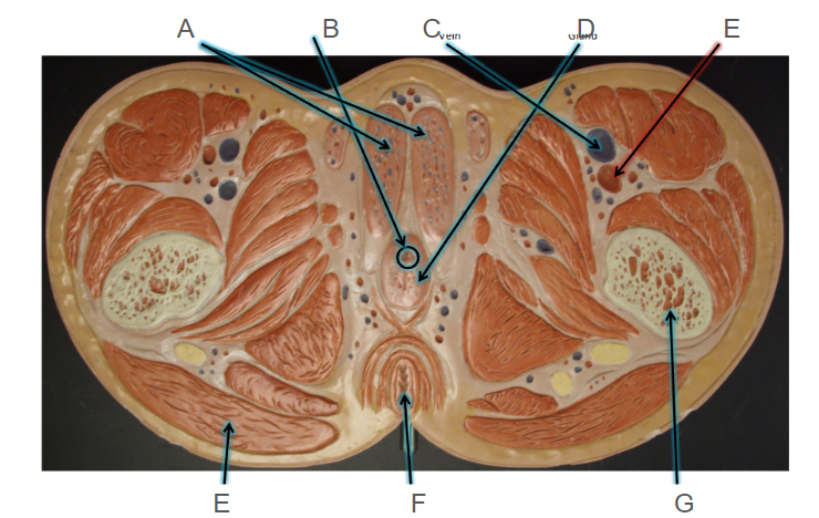 <p>E</p>