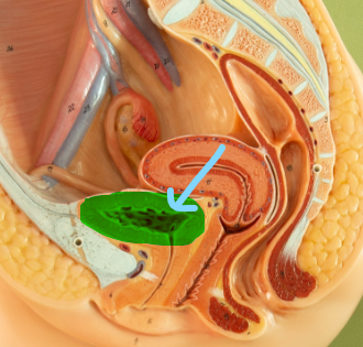 <p>Identify what the highlight/pointed to portion of the model is called.</p>