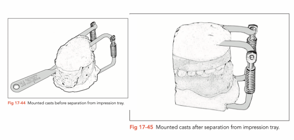 <ul><li><p>Pour dental stone model and fix it onto a articulater</p></li><li><p>Cut circumferentially around the abutment teeth with blade, teeth walls are almost visible</p></li></ul><p></p>