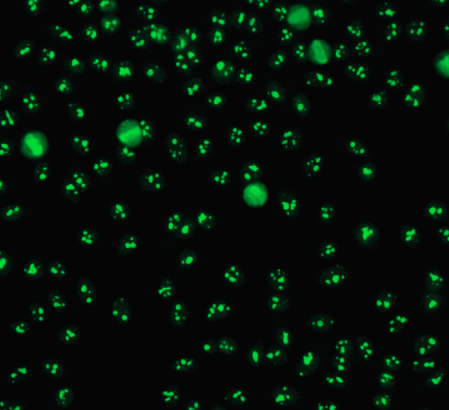 <p><span>Reflects an antibody to <u>nucleolar RNA (4-6S RNP)</u></span></p><p><span>Present in approx. 50% of patients with scleroderma, Sjögrens, and SLE. Also seen in Raynaud phenomenon</span></p>