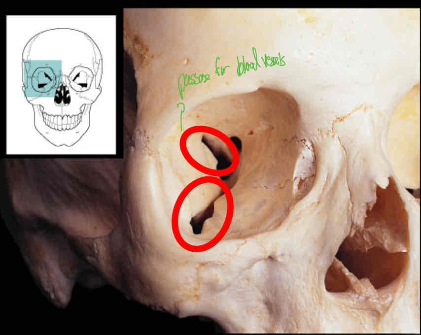 <p>Identify this </p>