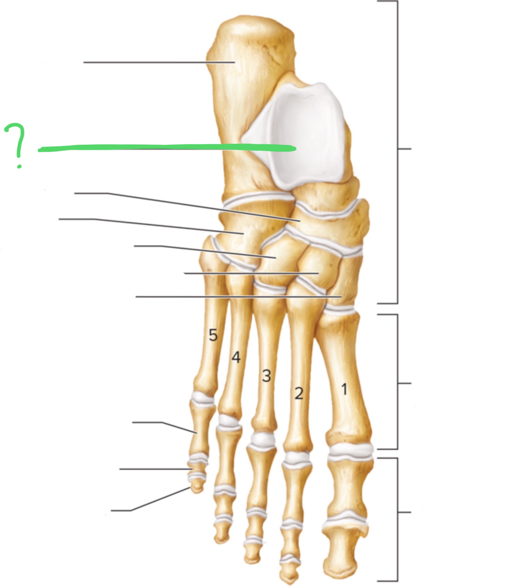 <p>What bone is this?</p>
