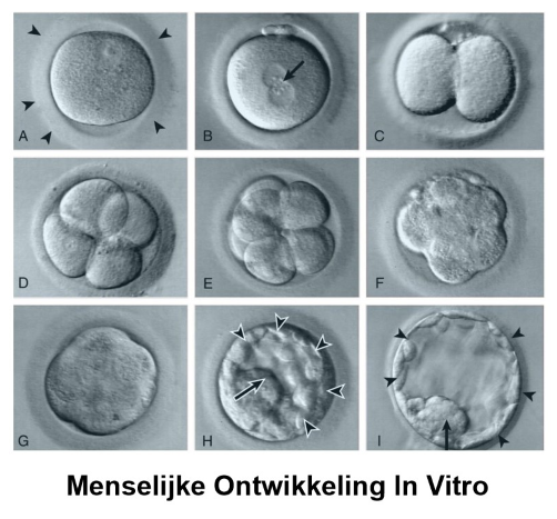 <p>A) ovulerende secundaire eicel voor de introductie van sperma &amp; bevruchting</p><ul><li><p>eicel bevat zona pellucida (pijlpunten)</p></li></ul><p>B) kort na in vitro fertilisatie (IVF) → vorming van mannelijke &amp; vrouwelijke pronuclei (pijl)</p><p>C) tweecellig stadium</p><p>D) viercellig stadium</p><p>E) achtcellig stadium</p><p>F) start van de ontwikkeling van morula = initiatie van de compactie</p><p>G) morula</p><p>H) vroege blastocyst, met trofoblast (pijlpunten) &amp; binnenste celmassa (pijl)</p><ul><li><p>vrijkomen uit de zona pellucida heeft niet plaatsgevonden</p></li></ul><p>I) ‘hatched’ blastocyst, met trofoblast (pijlpunten) &amp; binnenste celmassa (pijl)</p><ul><li><p>zona pellucida is verdwenen</p></li></ul><p></p>