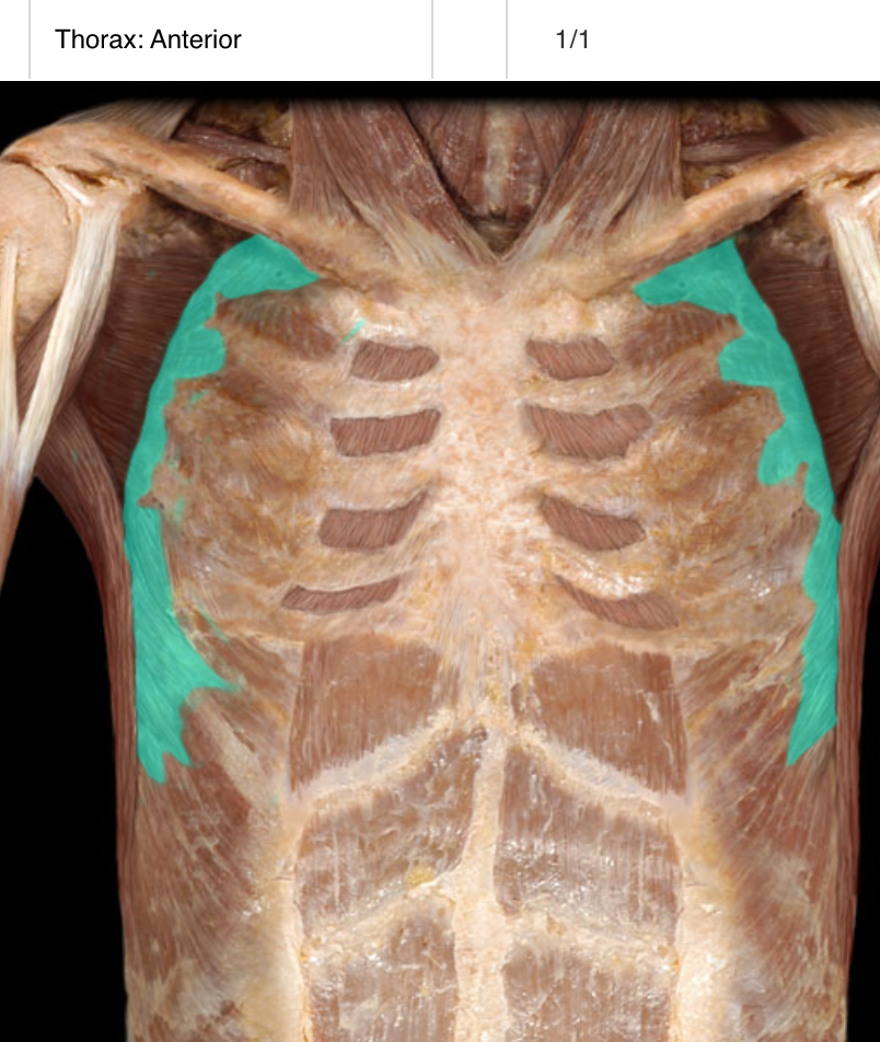 <p>A muscle located on the side of the thorax that is responsible for protraction and stabilization of the scapula. It originates from the upper eight or nine ribs and inserts along the medial border of the scapula. </p>