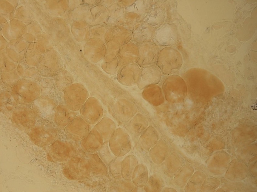 <p>Vienalasiai adipocitai</p><p>Tinkliniu skaidulu tinklas</p>