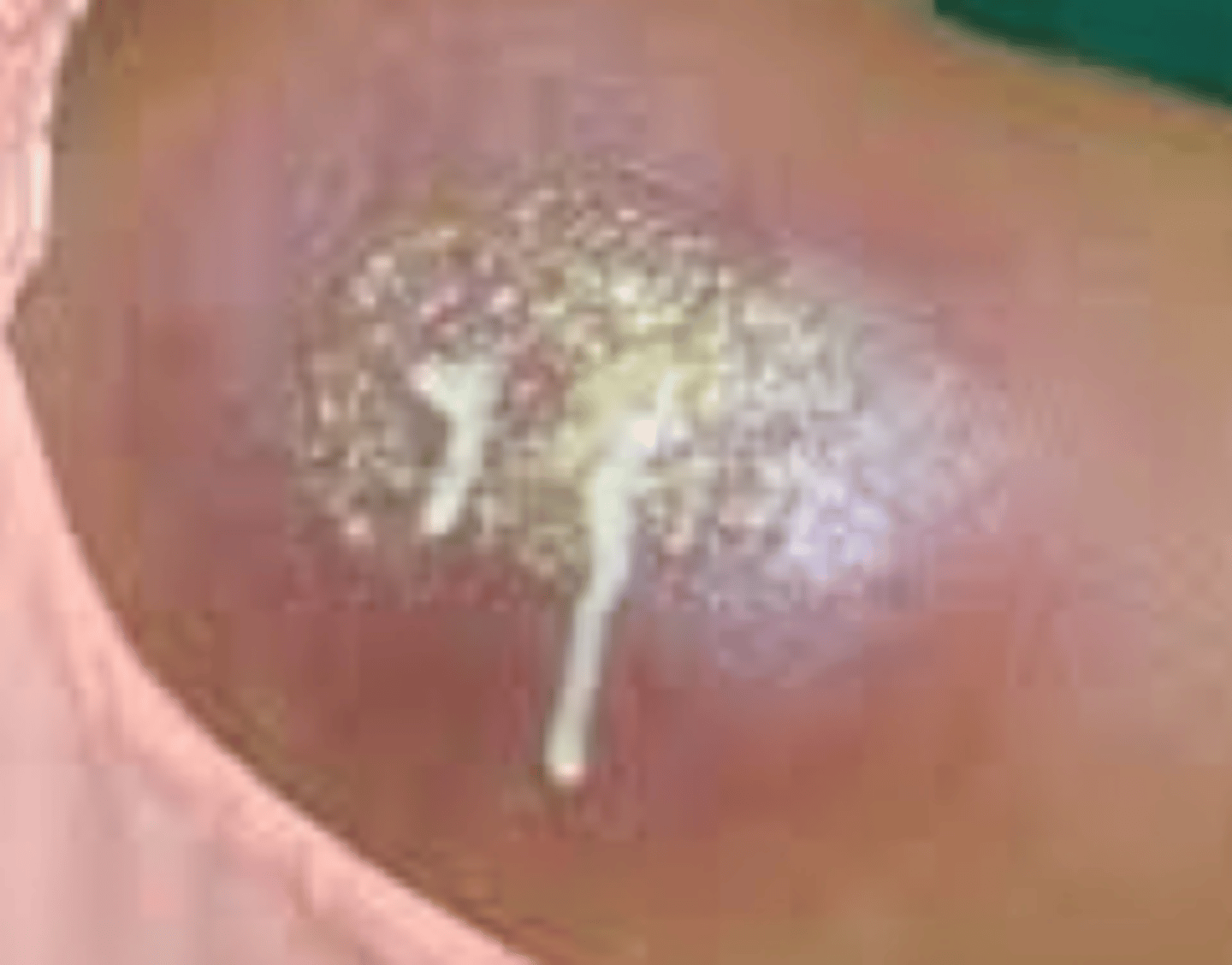 <p>What is the diagnosis?</p>