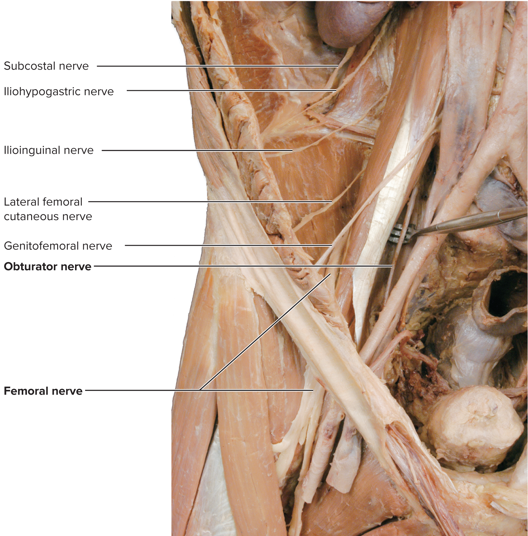 <p>Lumbar Plexus (L1–L4)</p>