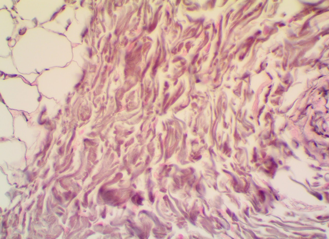 <p><span>Found in the reticular layer of the dermis</span></p>