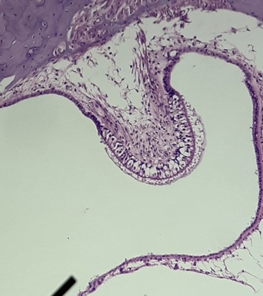 <p>Special: Hearing</p><p>an elevation at the base of each of the semicircular ducts of the inner ear; contains hair cells that alter the movement of endolymph within the ampulla with rotational forces; involved in equilibrium and balance.</p>