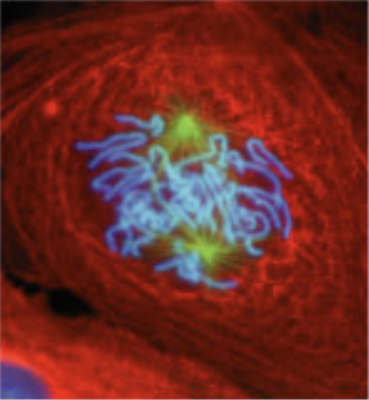 <p>what stage of mitosis?</p>
