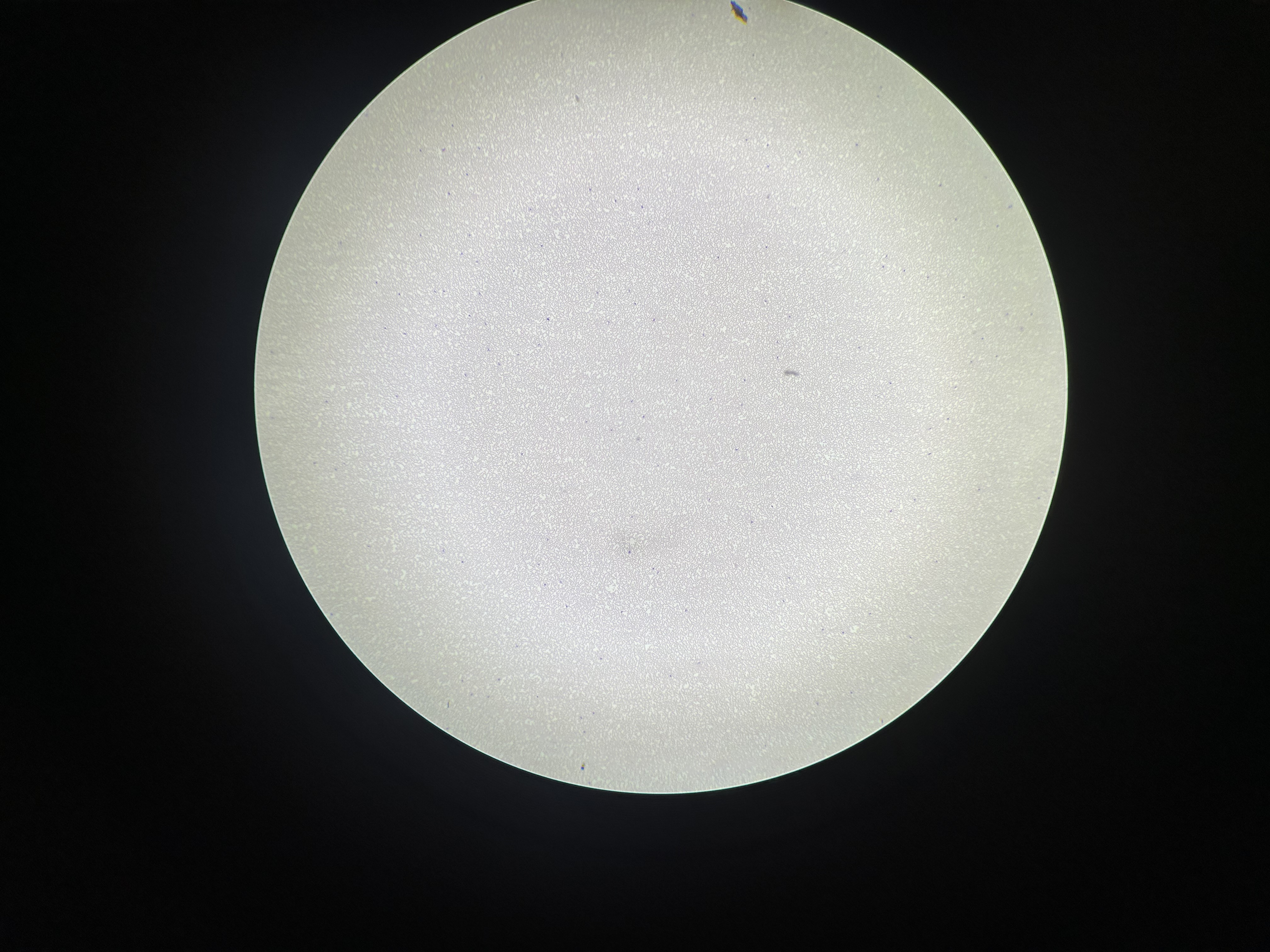 <p>What is the magnification level of the Blood?</p>