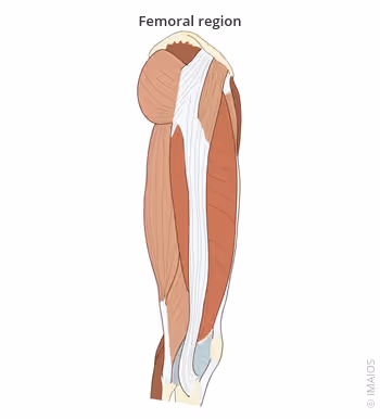<p>relating to the femur (long thigh bone)</p>