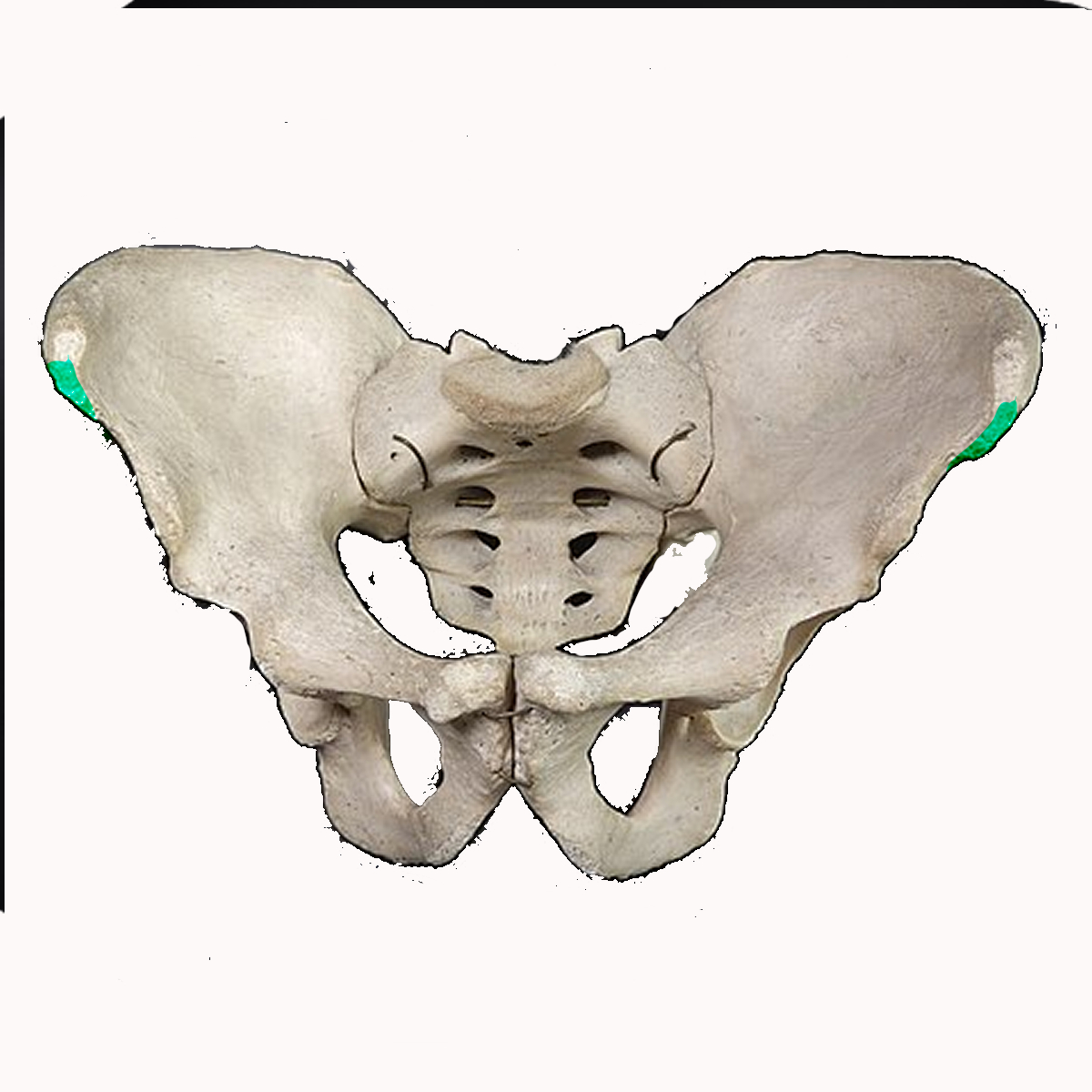 <p>Name the highlighted feature of the pelvis</p>