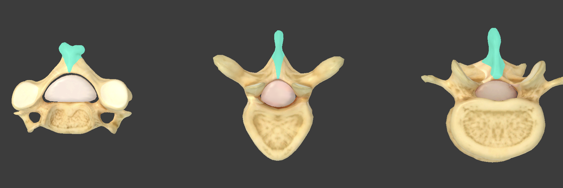 <p>what component of vertebrae is this?</p>
