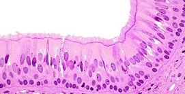 <p>= din p. apical</p><p>= proiecții mobile cu mișcare sincronă pentru a prpulsa fluidele și particulele de-a lungul suprafeței (ex: epiteliul respirator din căile aeriene).</p>