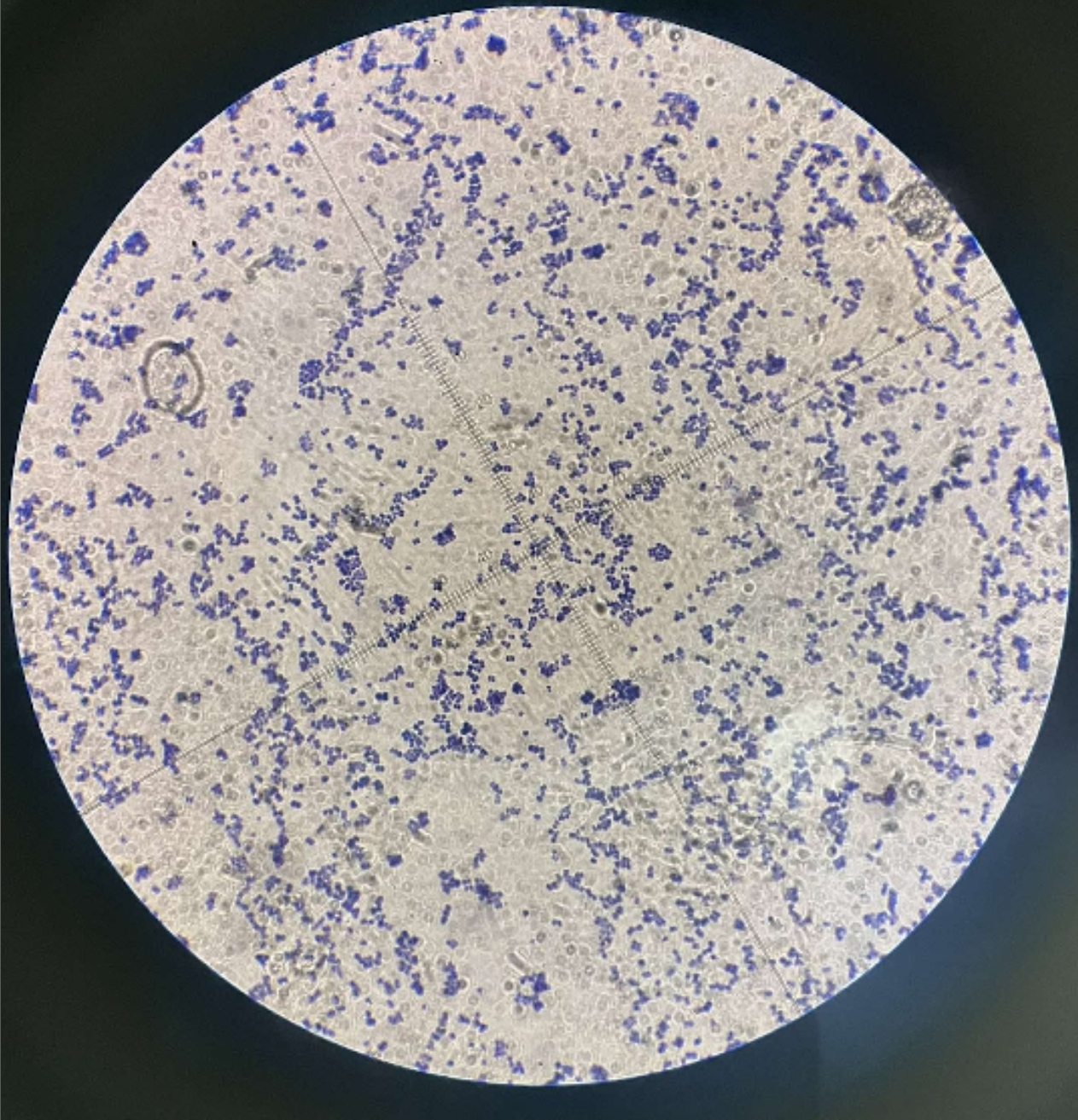 <p><em><mark data-color="#decdff" style="background-color: #decdff; color: inherit">Sarcina lutea</mark></em></p><ul><li><p class="has-focus">Spherical (cocci)</p></li><li><p class="has-focus is-empty">Cubical packets of 8 cells (sarcina arrangement<span style="font-size: 1.6rem">)</span></p></li><li><p class="has-focus is-empty">Purple or blue</p></li><li><p class="has-focus is-empty">Gram-positive</p></li><li><p class="has-focus is-empty">Non-pathogenic and rarely causes diseases</p></li></ul><p></p>