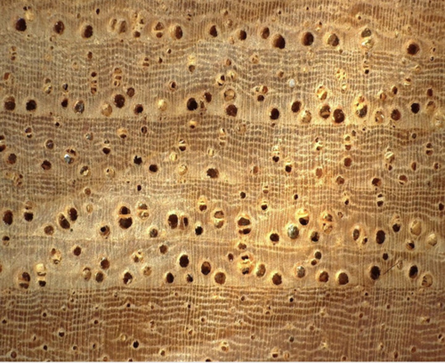 <p>Topography and its long aliform confluent parenchyma</p>