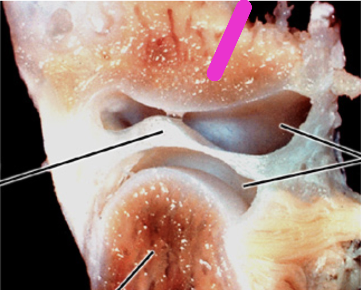 <p>Identify the structure</p>