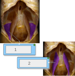 <p>name muscles 1 and 2</p>