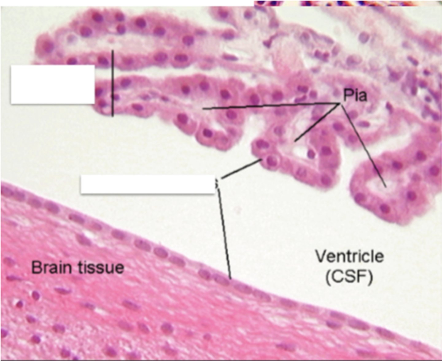 <p>Identify the structure</p>