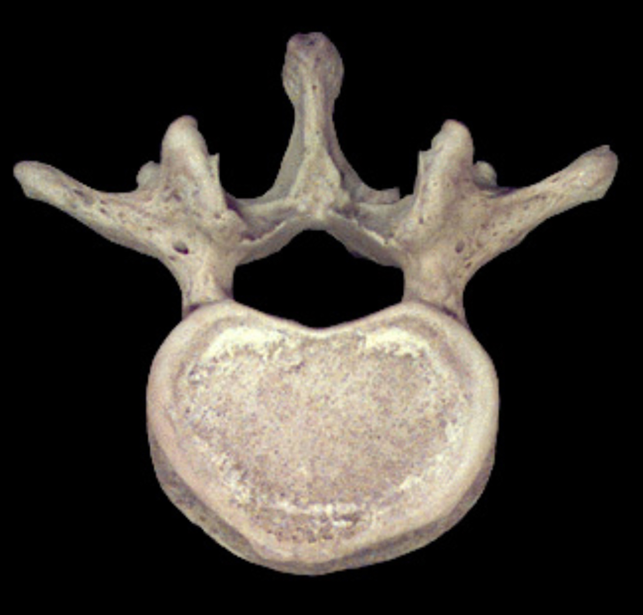 <p>What is this bone?</p>