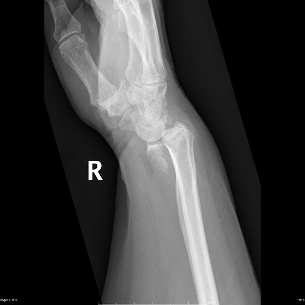 <p>Describe the abnormality demonstrated.</p>