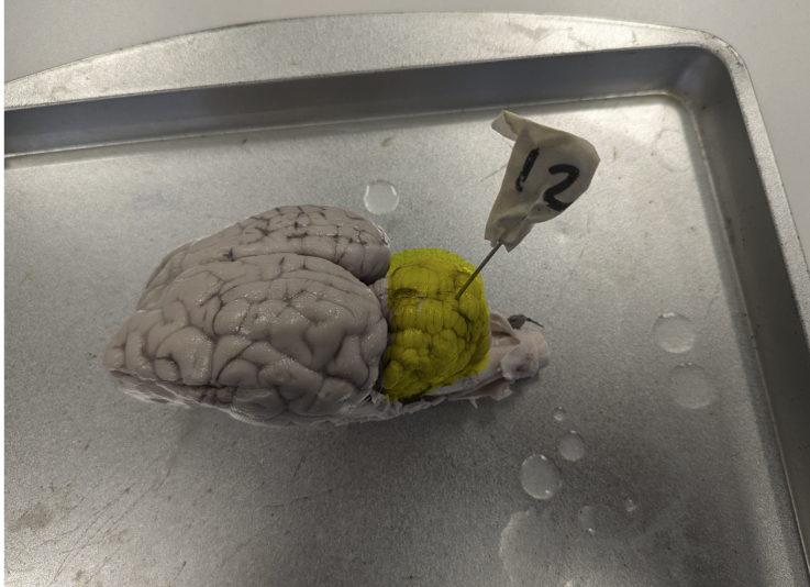 <p>What portion of the brain is highlighted?</p>