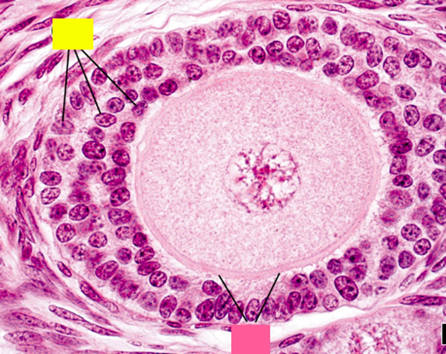 <p>ID the yellow structure:</p>