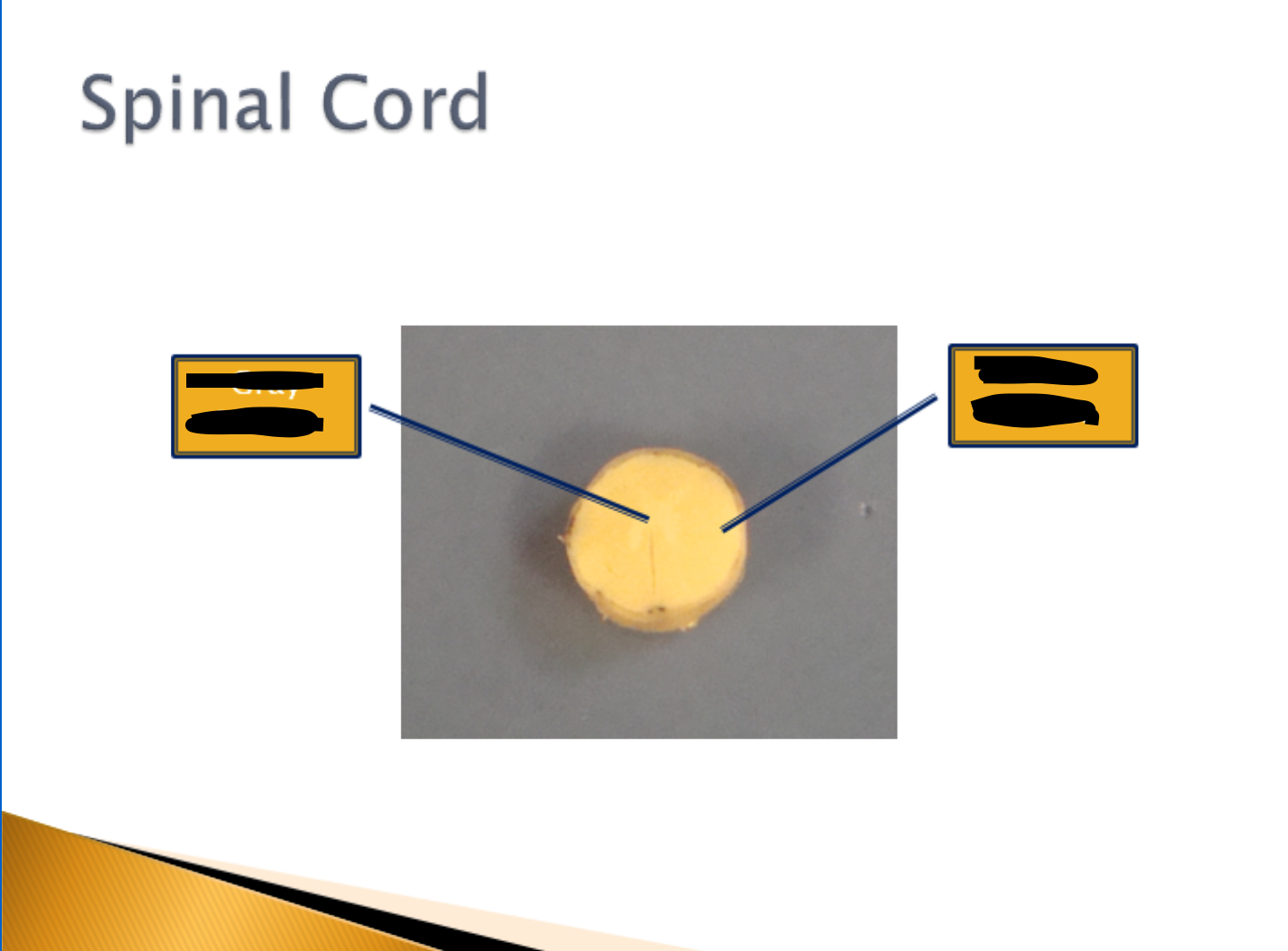 <p>Spinal Cord</p>